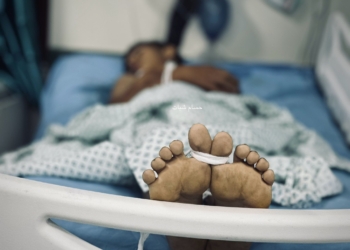 «لماذا يسمح العالم بالمجاعة في غزة؟»: شهادة طبيب غربي عن التجويع المتعمد